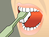 brushing bottom teeth diagram for preventative dental care