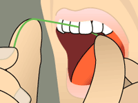 flossing in between front teeth for preventative care