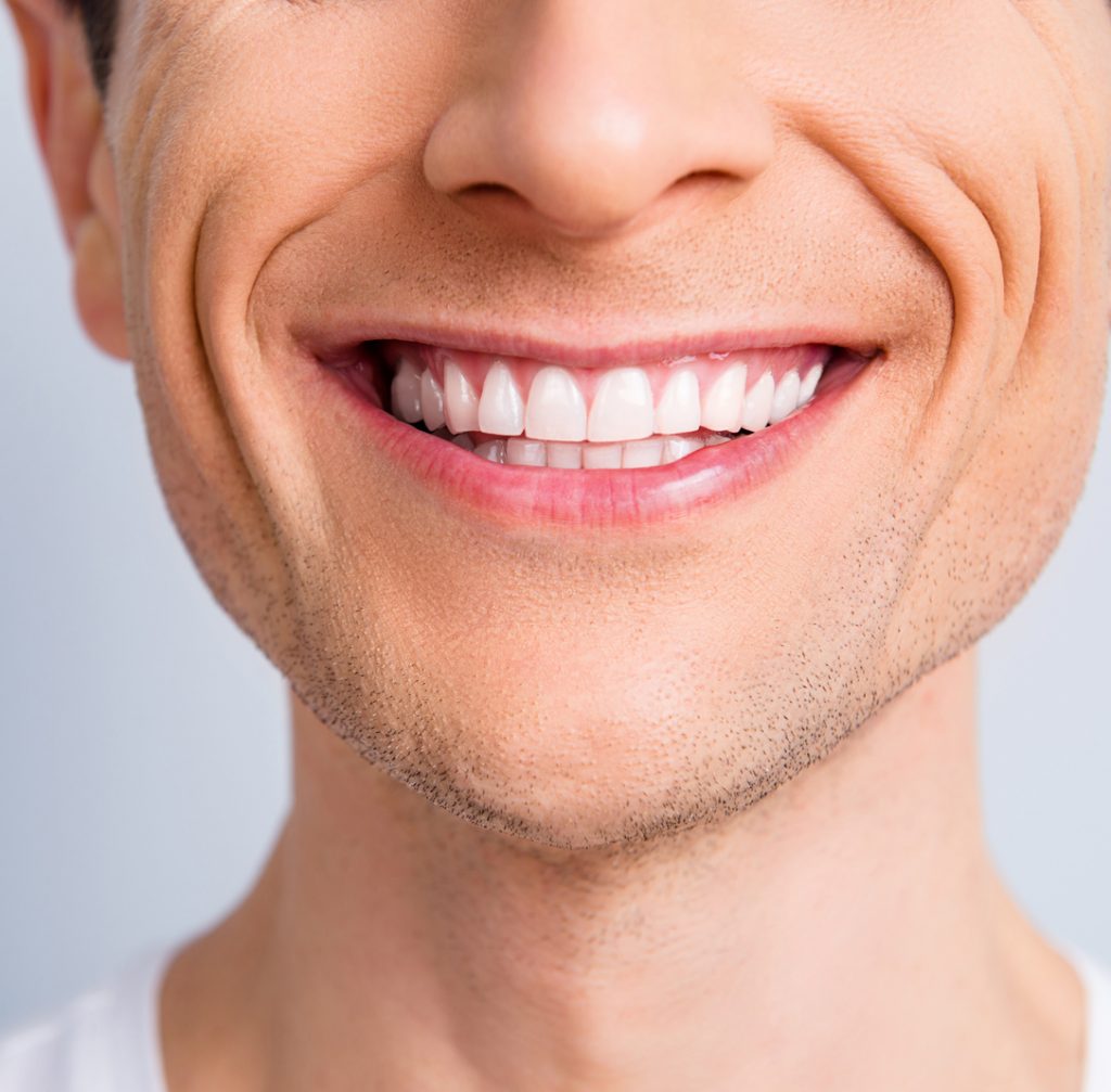 close up of man's mouth with a healthy smile from bridges